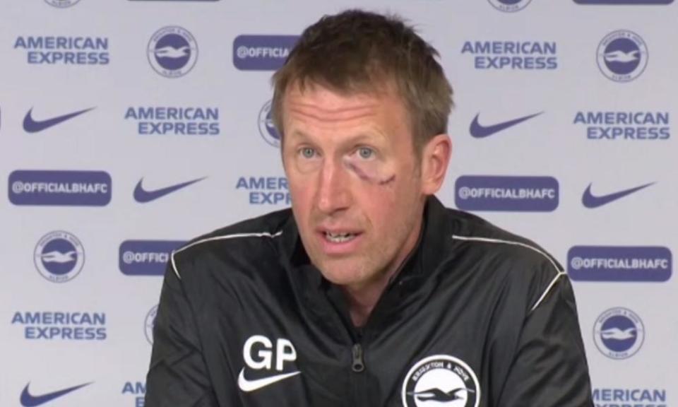 Graham Potter sporting one hell of a shiner at his presser today.