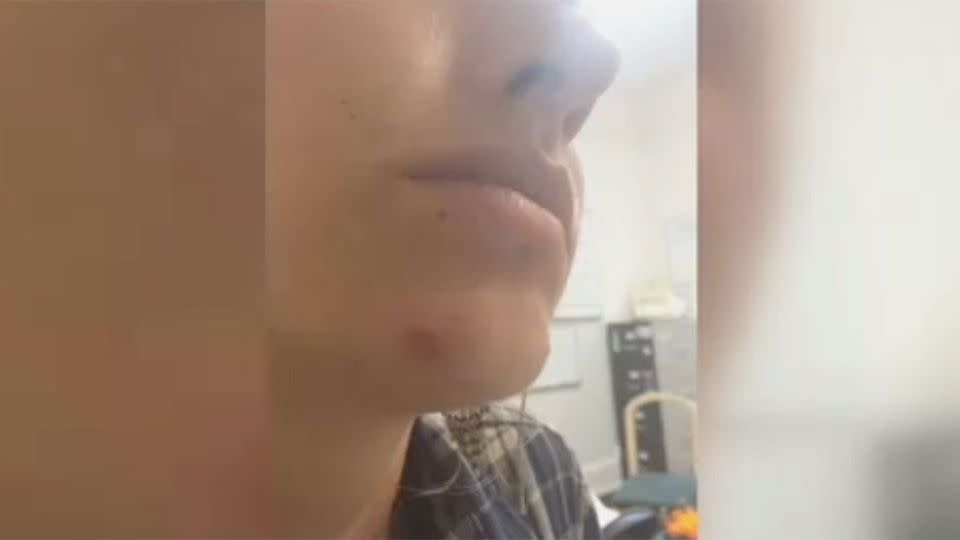 The lesbian couple claim they were physically abused and beaten while being held in police custody, they are now suing. Photo: Hawaiian News Now