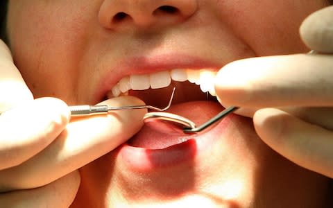 People missing teeth were also found to be more nutritionally deficient  - Credit:  Martin Rickett