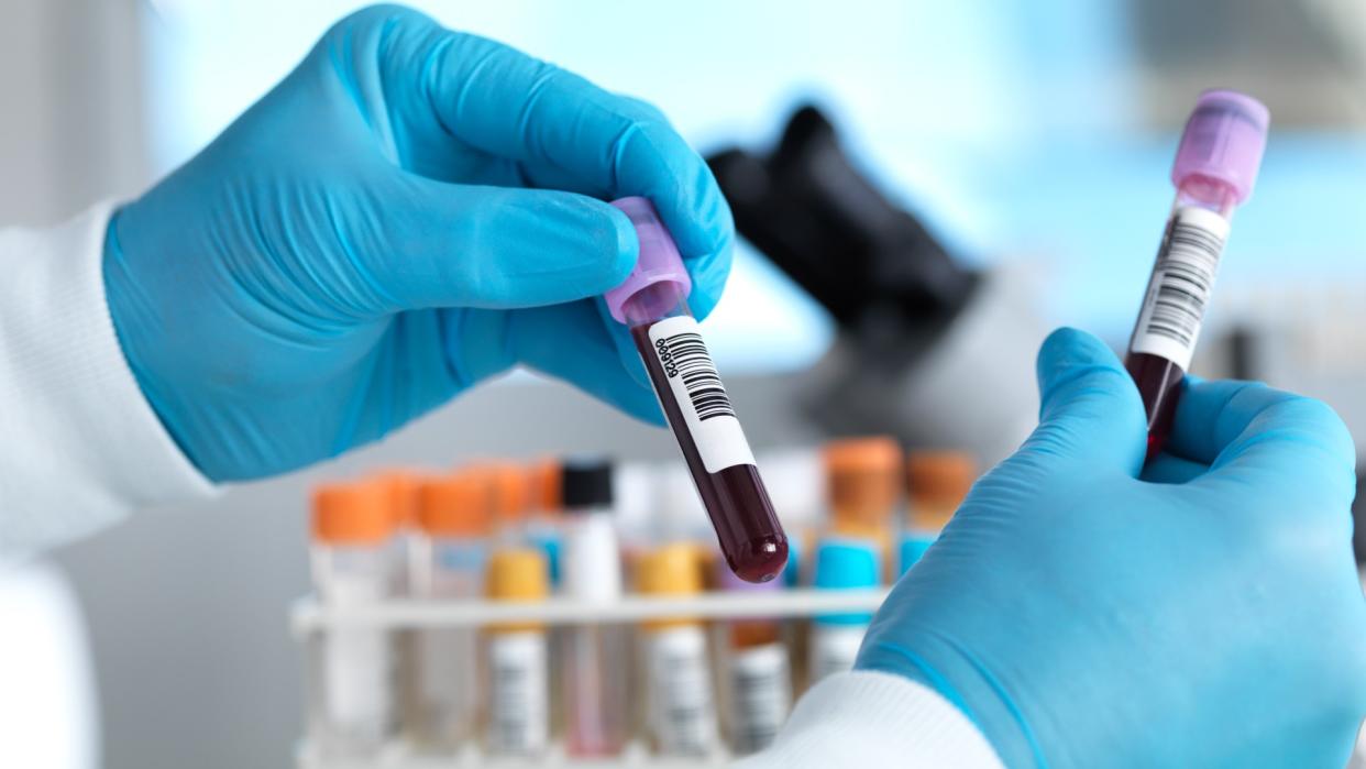  Hand holding blood sample in laboratory. 