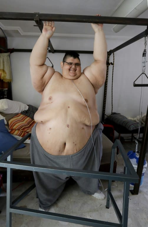 Franco -- shown exercising in his home -- has lost 250 kilos (550 pounds)