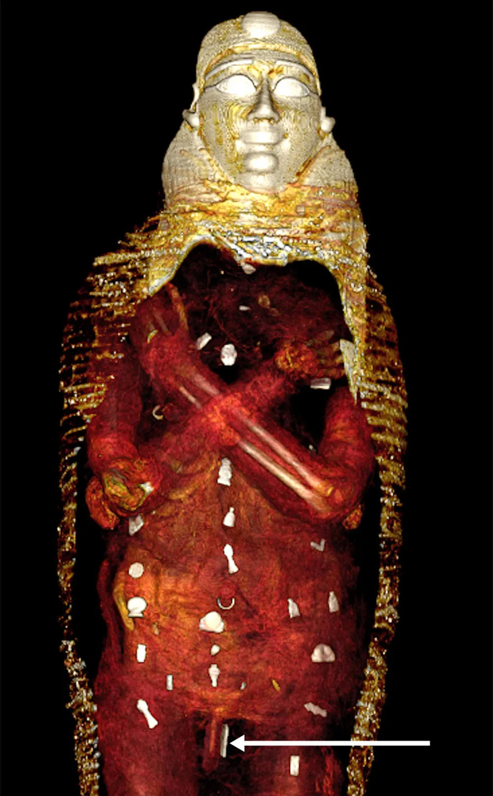 Wrappings are digitally removed to reveal amulets covering the body. (Sahar Saleem / Cairo University)