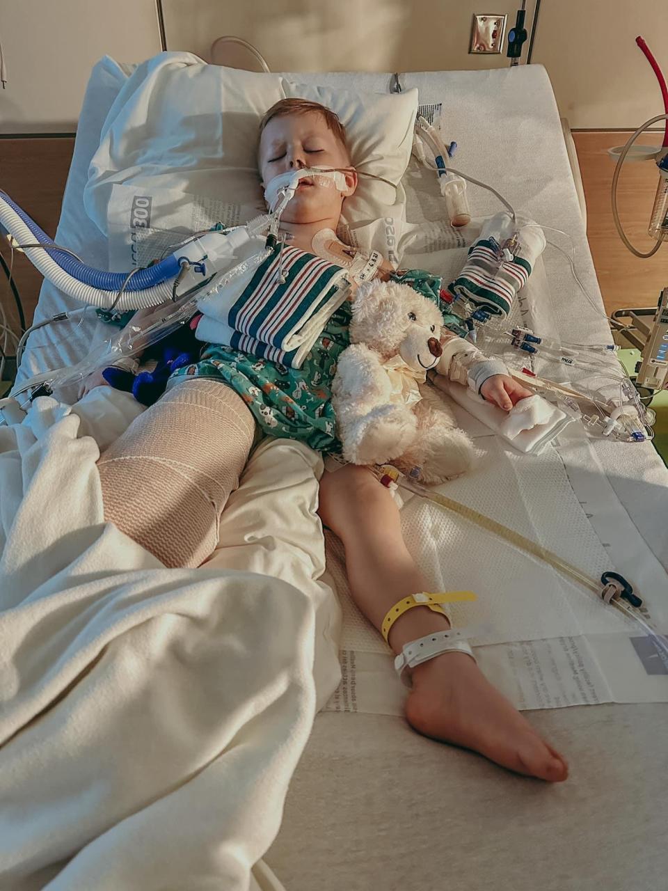 Three-year-old Zeke Clark of Lewes, pictured here at Nemours Children's Hospital, lost his leg below the knee in a June 7 lawnmower accident.