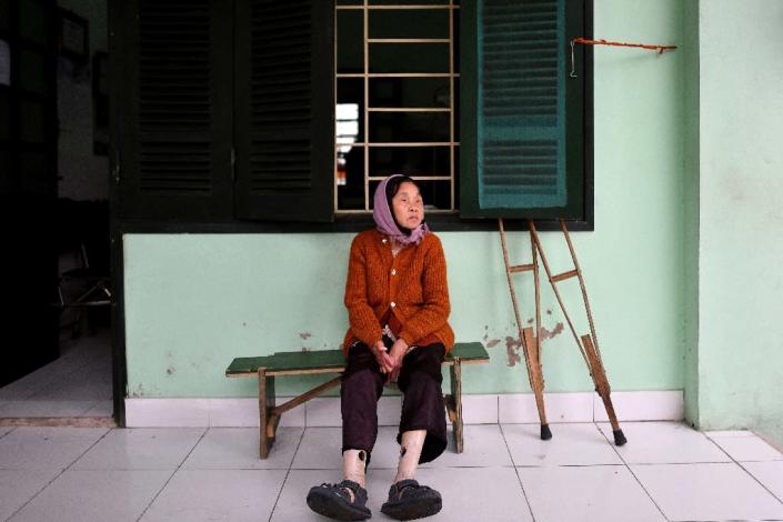 At its peak Van Mon Leprosy Hospice treated 4,000 patients a year -- a number that has dwindled as leprosy cases have dropped across Vietnam thanks to improved healthcare, hygiene and greater awareness of the disease (AFP Photo/Manan VATSYAYANA)