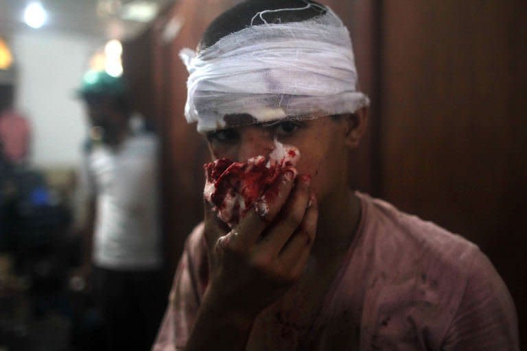 An injured Egyptian youth is seen at a makeshift hospital during clashes between supporters of Egypt's ousted president Mohamed Morsi and police in Cairo on August 14, 2013