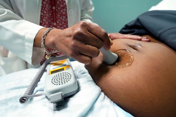 PHOTO: FILE - A doctor uses a hand-held Doppler probe on a pregnant woman to measure the heartbeat of the fetus on Dec. 17, 2021, in Jackson, Miss. (Rogelio V. Solis/AP, FILE)