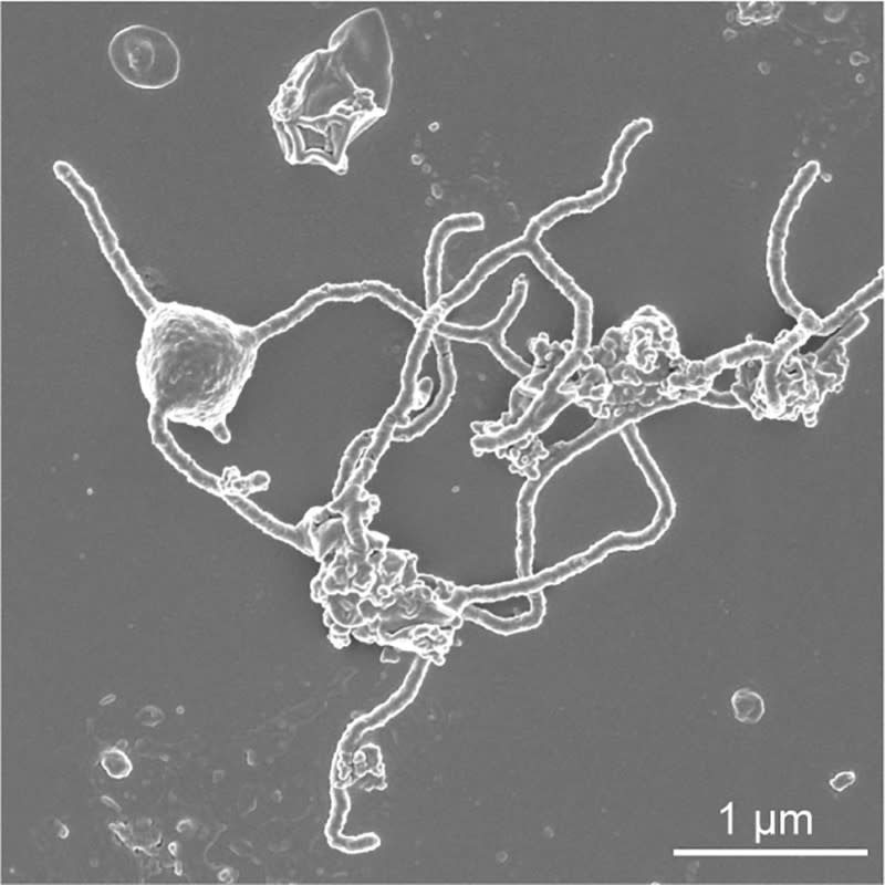 A scanning electron microscopy image of the single-celled organism Prometheoarchaeum syntrophicum strain MK-D1