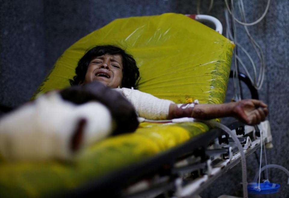 Un niño de 12 años llora en una camilla de un hospital de Saná (Yemen) al que fue trasladado de urgencia tras un ataque aéreo en la provincia de al-Jawf. Imagen del 15 de julio. (Foto: Khaled Abdullah / Reuters).