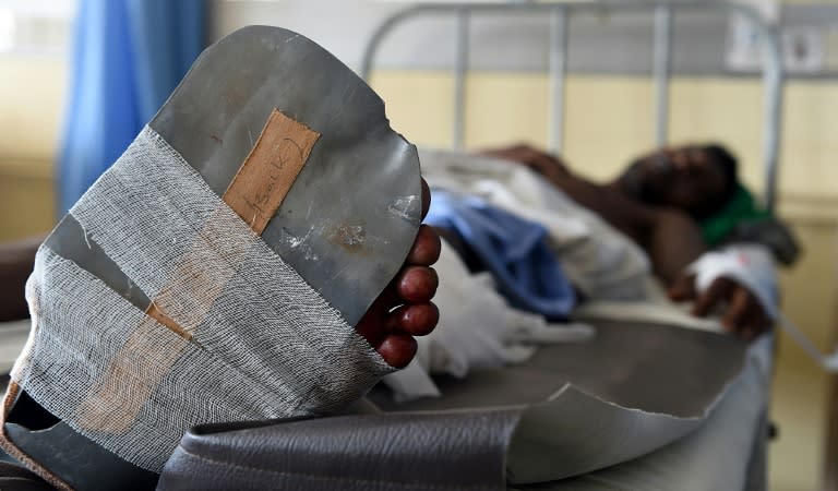 A Sri Lankan man, wounded during the shooting at a ruling party election rally, is treated at the main hospital of Colombo on July 31, 2015