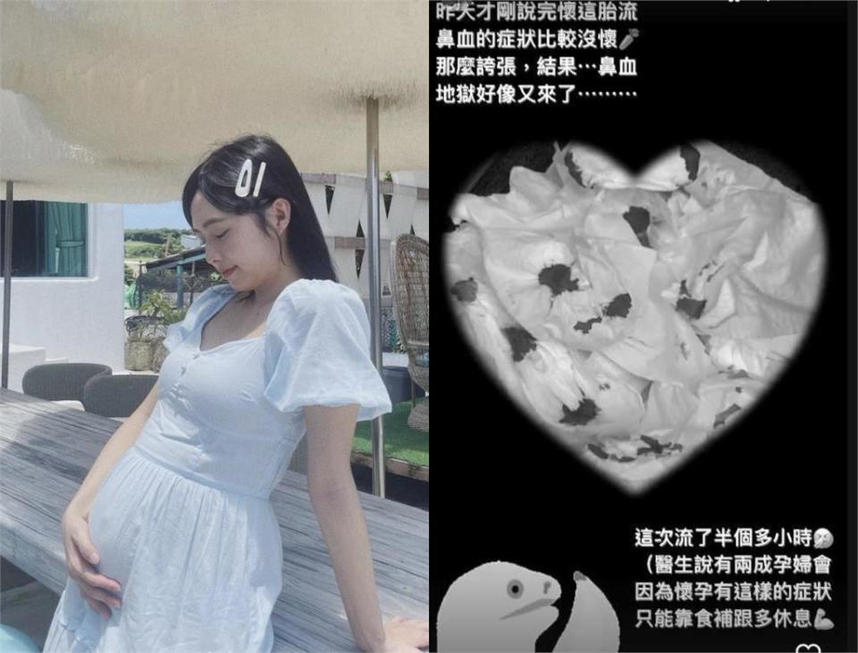 「最美校花」簡廷芮懷二胎鼻血狂流！1黑白照「衛生紙全血」嘆：地獄又來