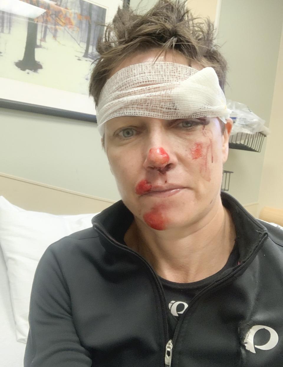 Today correspondent Stephanie Gosk's bike accident