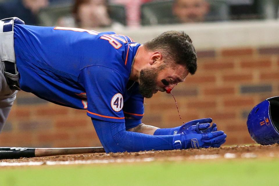 Kevin Pillar bleeds from the nose after being hit by a 94.5 mph pitch.