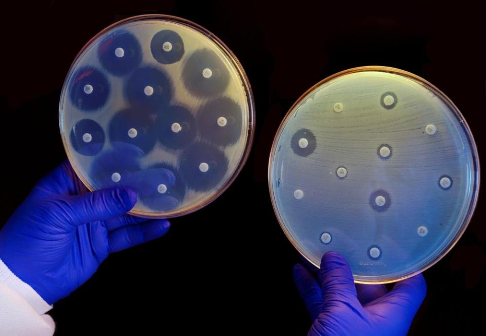 Two plates growing bacteria in the presence of discs containing various antibiotics. The isolate on the left plate is susceptible to the antibiotics on the discs and is unable to grow around them The one on the right is resistant to all of the antibiotics tested and is able to grow unimpeded.