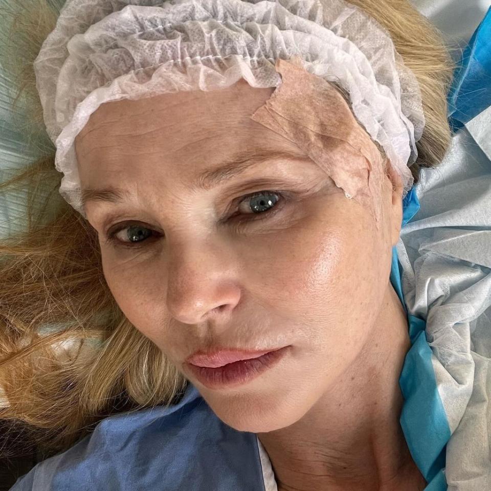 Christie Brinkley, Skin Cancer, Instagram