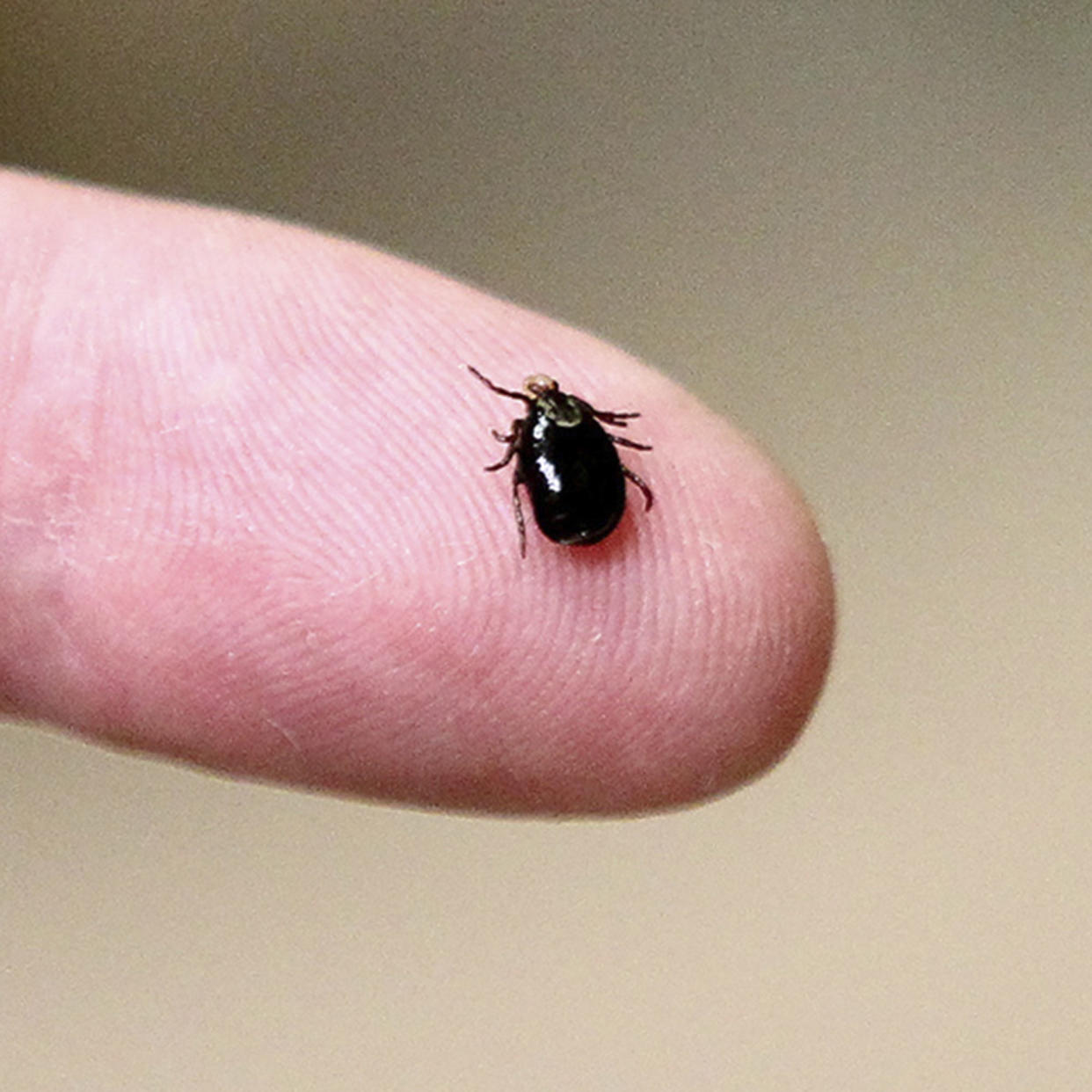 Ticks are extremely small, so it's important to do thorough checks regularly if you or your pet spend any time outdoors. (Paul Connors / The Sun Chronicle via AP)