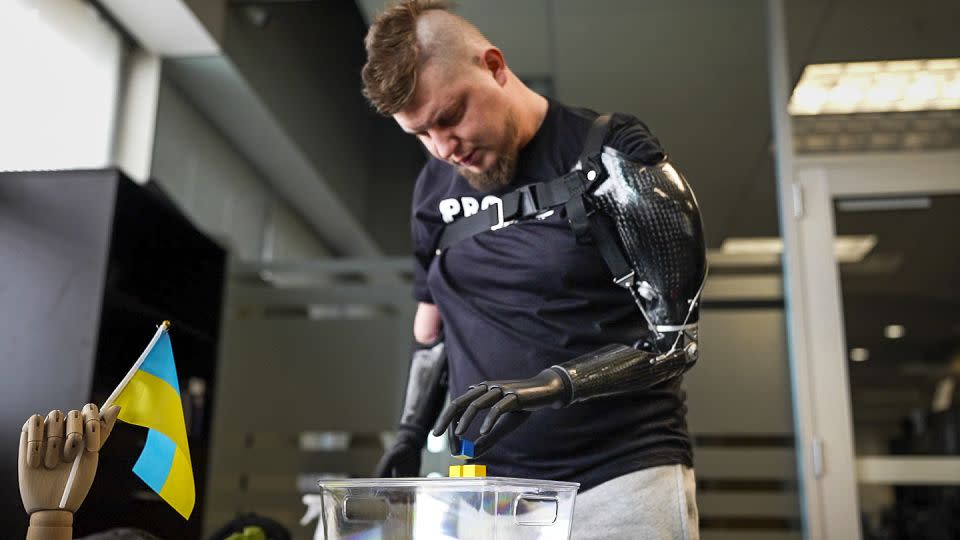 Ukrainian soldier Valera Kucherenko working with his bionic hands. - CNN