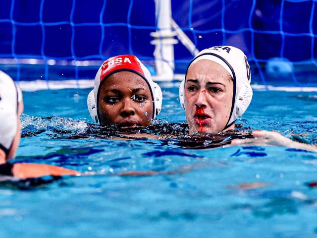 A water polo superstar broke her nose mid-match, gushed blood into