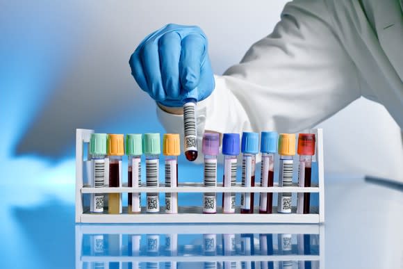 Gloved hand holding a blood sample vial.