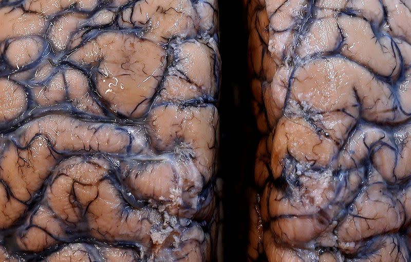 FILE PHOTO: A human brain, part of a collection of more than 3,000 brains that could provide insight into psychiatric diseases, is seen at the psychiatric hospital in Duffel
