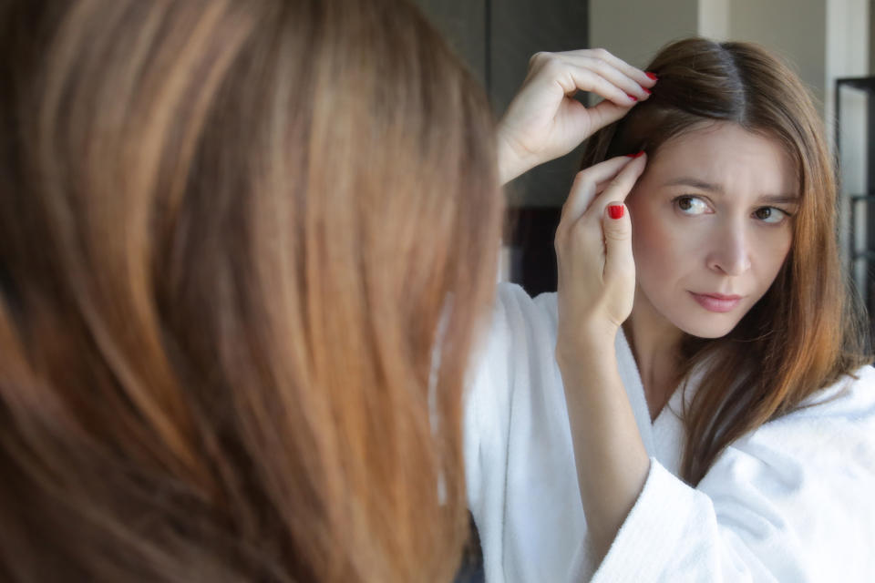 Woman suffering with hair loss. (Getty Images)