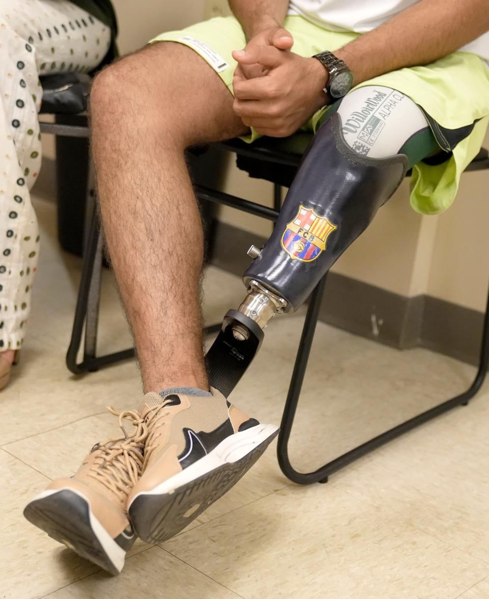 Abdullah Mukhaimer, 16, visits Ace Prosthetics in Upper Arlington for an appointment to fine-tune his new prosthetic, which the company donated and decorated with an FC Barcelona sticker in honor of Mukhaimer's favorite team.