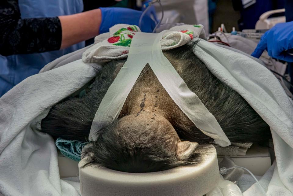 Medical personnel position Qasai face down for surgery. Wade Mueller, a Froedtert neurosurgeon, used a black pen to indicate that important blood vessels lay below.