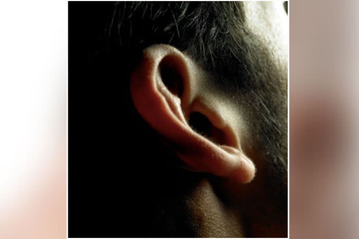 The top half of the man's ear was bitten off during the brawl. Photo: Getty file image.