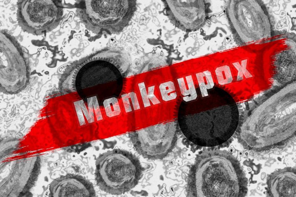 印度通報亞洲首起可能的猴痘死亡病例。示意圖。(Pixabay圖庫)