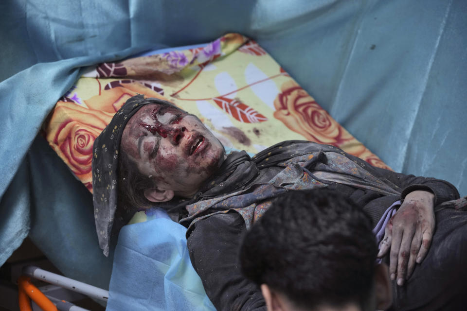 A Palestinian, wounded in Israeli bombardment, waits for treatment in a Hospital in Deir al-Balah, southern Gaza Strip, Friday, Oct. 20, 2023. (AP Photo/Hatem Moussa)
