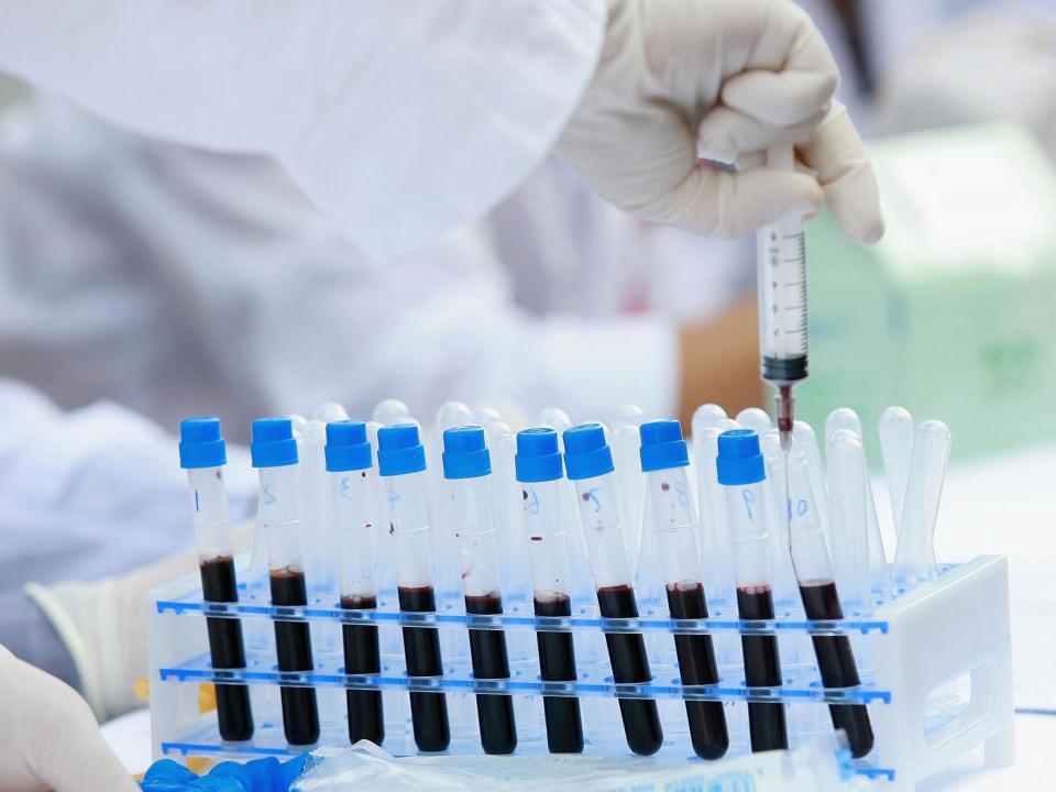 A new blood test is able to detect more than 50 types of cancer: China Photos/Getty Images