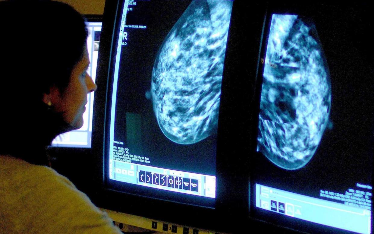 A consultant analyses a breast cancer mammogram - Rui Vieira/PA