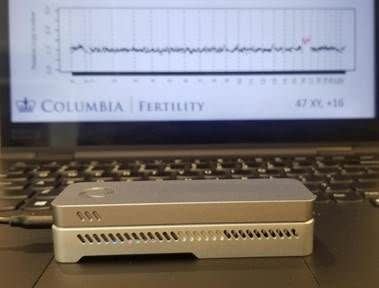 The STORK device, shown in front of an abnormal test result from a miscarriage. (Photo: Samuel Z. Williams)