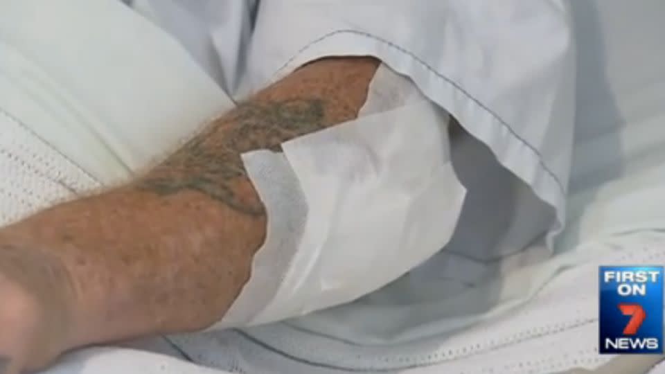 Mr Edwards was left with two broken ribs, a deep cut in one arm and plenty of grazes. Photo: 7News