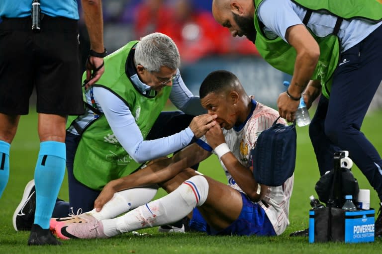 El jugador francés Kylian Mbappé, tras fracturarse la nariz en el partido contra Austria disputado el 17 de junio en Dusseldorf en la primera jornada de la Eurocopa (OZAN KOSE)