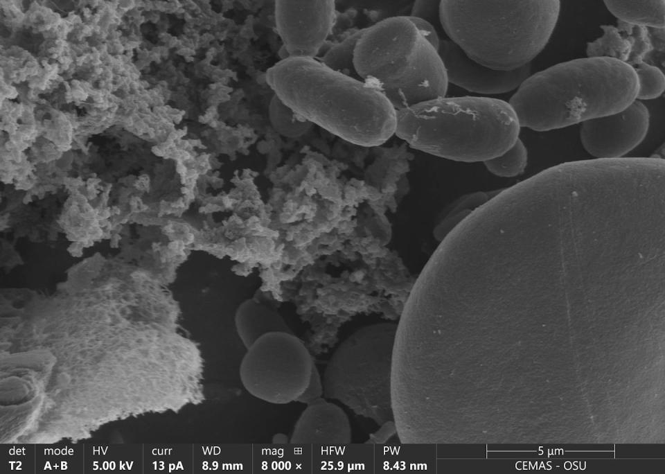 Microscopy image of rod-shaped bacteria, elongated and spherical yeast, and globular starch grains