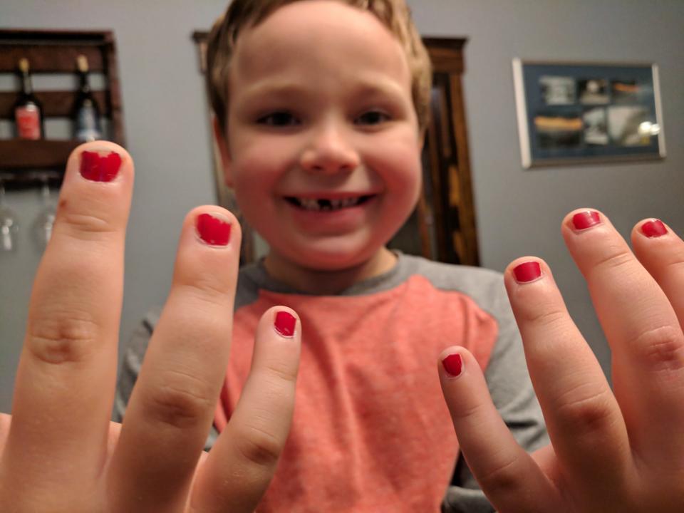 Five-year-old Sam was bullied for wearing nail polish to school, and his dad is speaking out about it. (Photo: Aaron Gouveia)