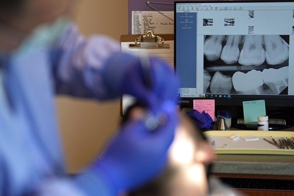 X-rays of Abdul Wasi Safi's teeth are shown on a monitor as he gets fillings during a clinic visit, Wednesday, April 26, 2023, in Houston. Safi's days since his release from a Texas immigration detention center have been filled with medical appointments while living in Houston with his brother. (AP Photo/David J. Phillip)