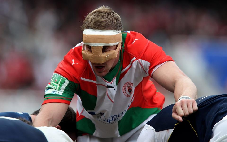 Imanol Harinordoquy of Biarritz wears a face protector during the 2010 Heineken Cup semi-final against Munster