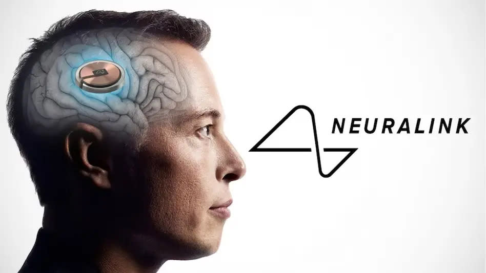 Everything You Have To Know About Neuralink and Our Brain's Future | Brand  Vision