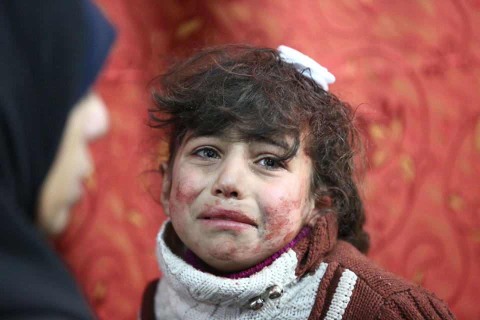 <p>Hala, 9, receives treatment at a makeshift hospital following Syrian government bombardments on rebel-held town of Saqba, in the besieged eastern Ghouta region on the outskirts of the capital Damascus on Feb. 22, 2018. (Photo: Amer Almohibany/AFP/Getty Images) </p>