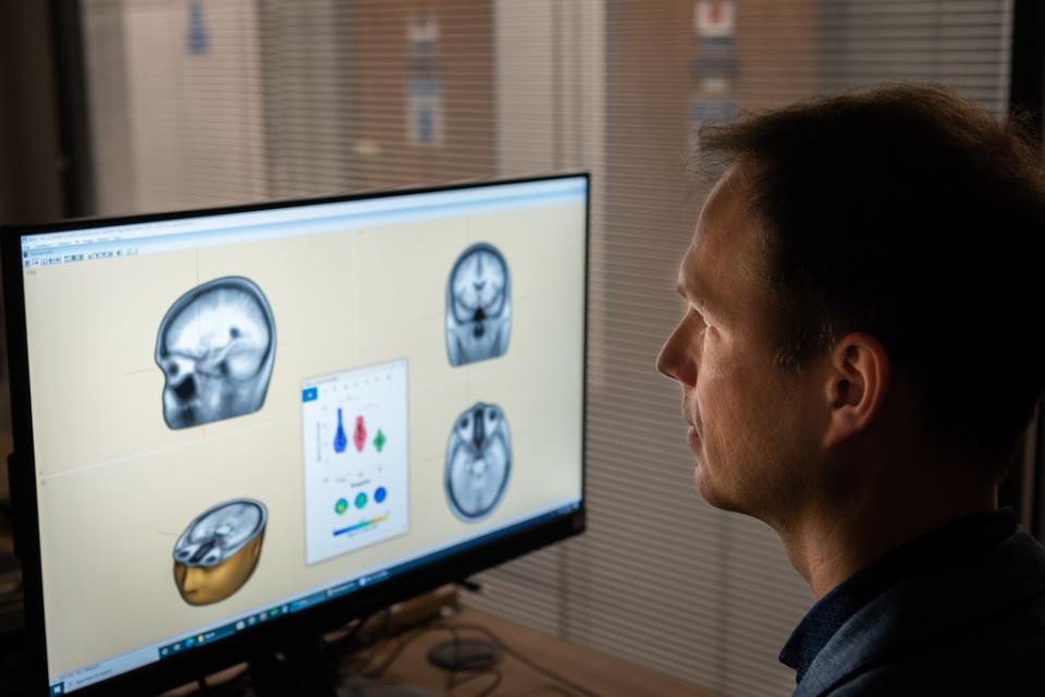 Lead researcher Dr George Stothart examines the results of brain scans (Nic Delves Broughton/University of Bath/PA)