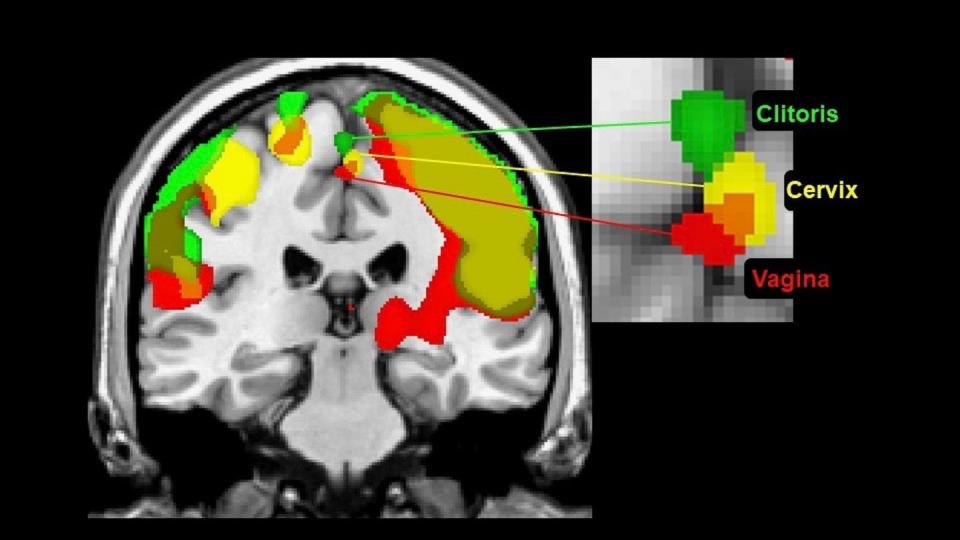 Cervical, clitoral and vaginal self-stimulation activate the same overlapping region of the sensory cortex, the paracentral lobule. Barry Komisaruk, <a href="http://creativecommons.org/licenses/by-sa/4.0/" rel="nofollow noopener" target="_blank" data-ylk="slk:CC BY-SA;elm:context_link;itc:0;sec:content-canvas" class="link ">CC BY-SA</a>