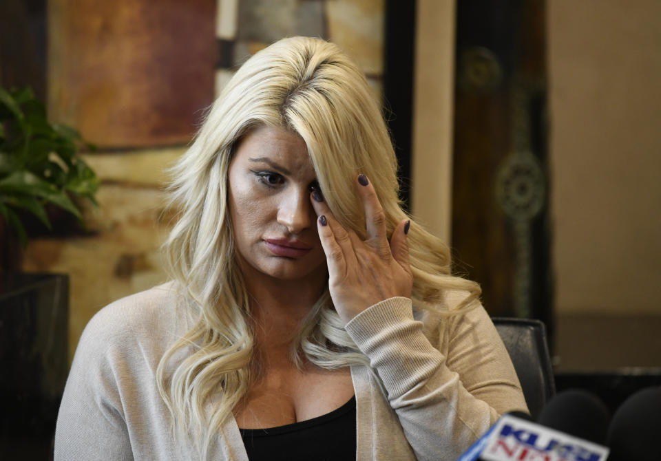 Chelsea Romo wipes her eye as she recounts some of the details of the Las Vegas Shooting at a news conference, Thursday, Oct. 3, 2019, in San Diego. Romo lost her left eye in the Las Vegas shooting. Two years after a shooter rained gunfire on country music fans from a high-rise Las Vegas hotel, MGM Resorts International reached a settlement that could pay up to $800 million to families of the 58 people who died and hundreds of others who were injured, attorneys announced Thursday. (AP Photo/Denis Poroy)