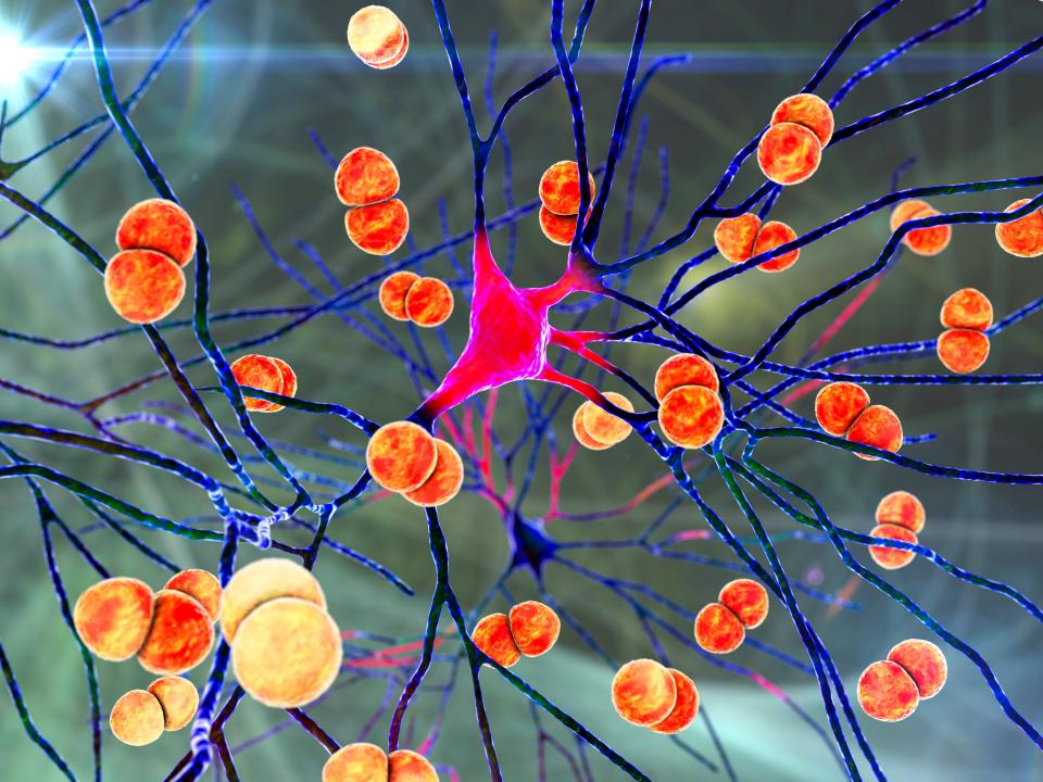 Conceptual computer illustration showing Streptococcus pneumoniae bacteria, one of the main causes of bacterial meningitis and meningoencephalitis, infecting brain cells.