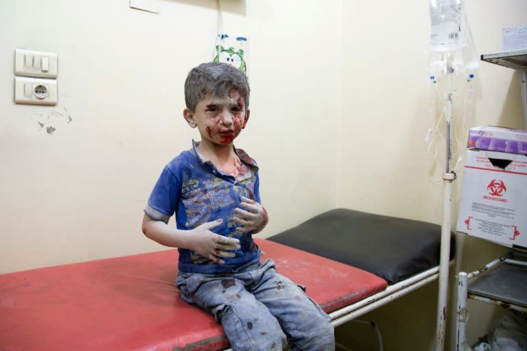 A Syrian boy awaits treatment at a makeshift hospital following air strikes on rebel-held eastern areas of Aleppo on September 24, 2016