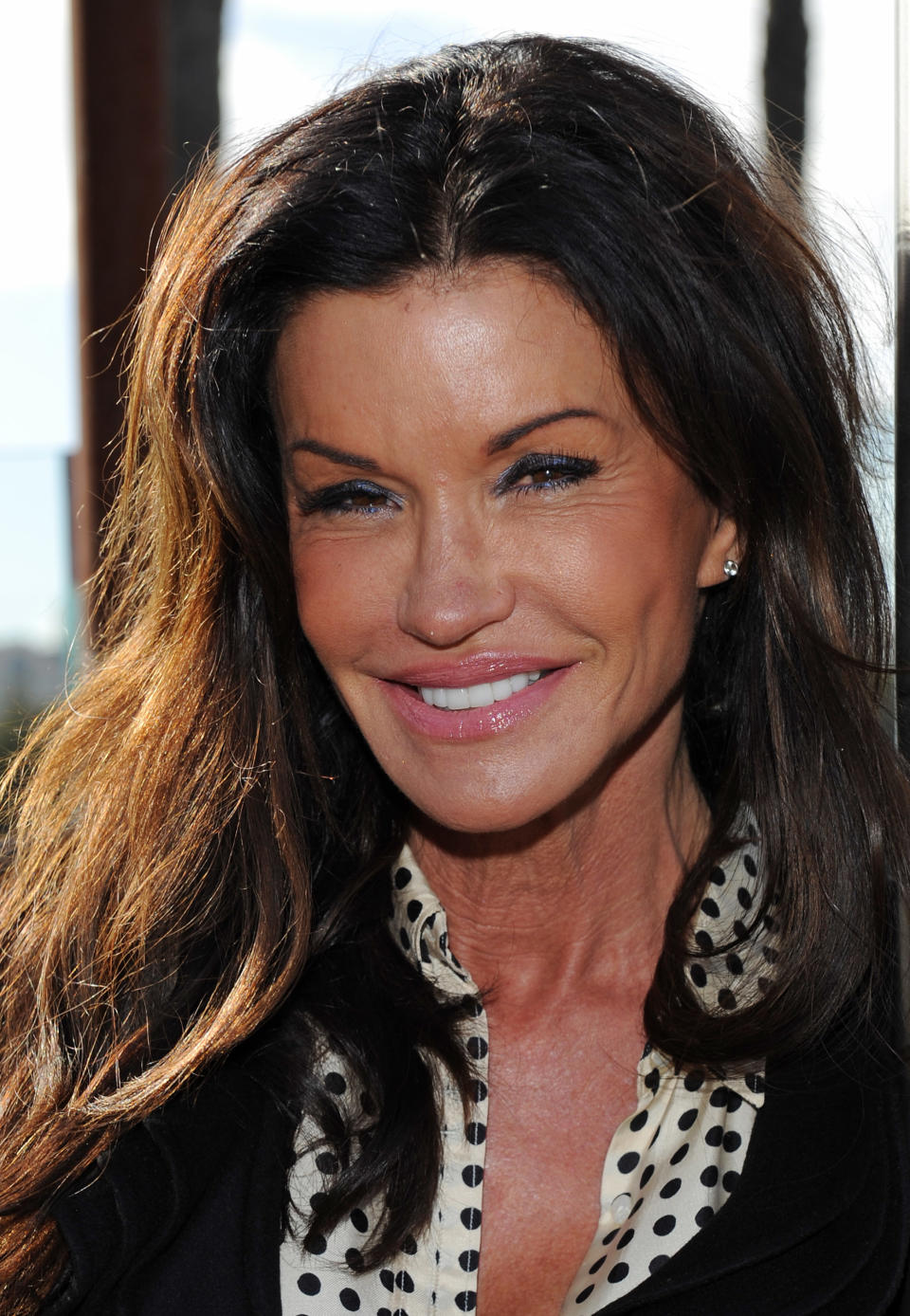 <div class="caption-credit"> Photo by: (Photo by JB Lacroix/WireImage)</div>Janice Dickenson was another early proponent of Botox. [I've gotten] Botox every six months since it became available," she told <i>People</i> in 2004. "I was the first in line. If it meant keeping me young, I was the first to sign up. I live for Botox."