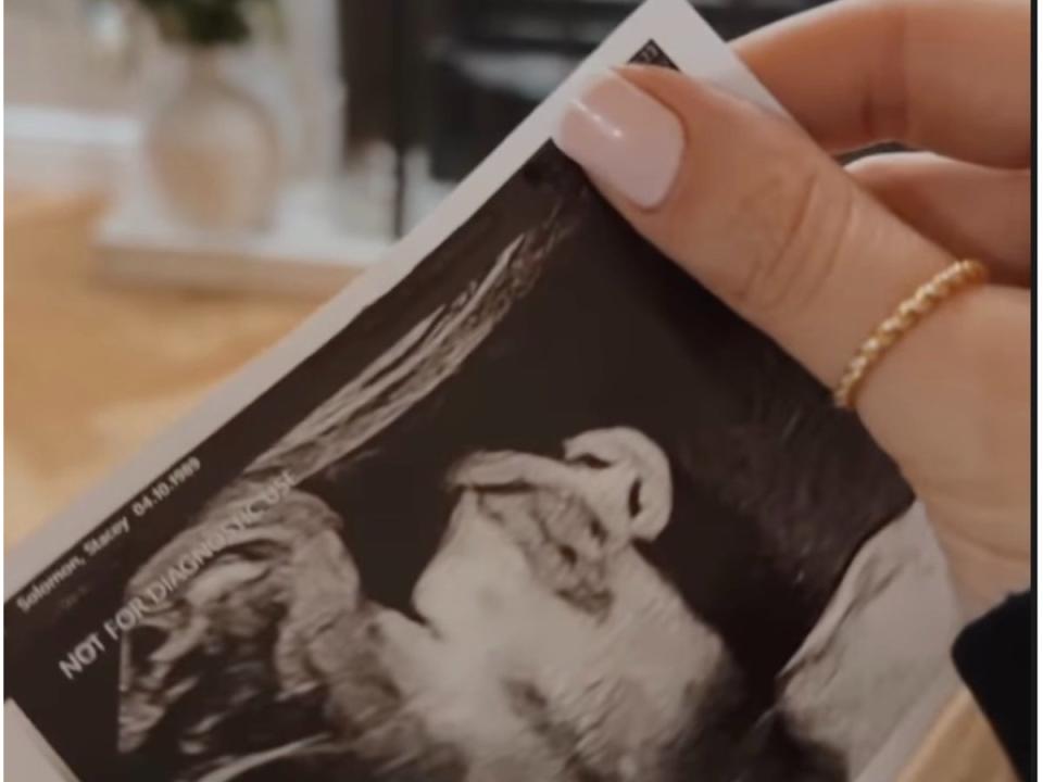 ‘Who’s lips are those?’ asked Solomon, holding up a picture of the scan (@staceysolomon / Instagram)