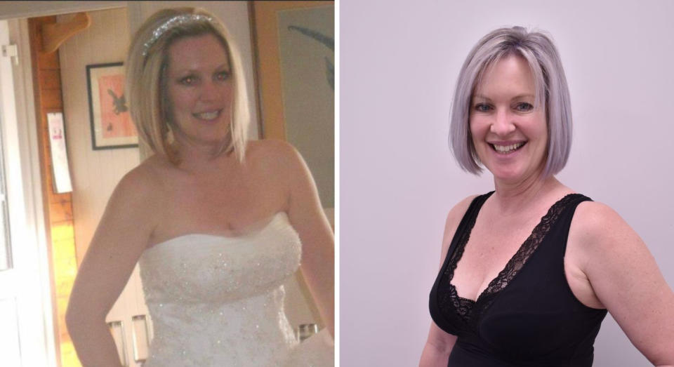 Corrie Tyrie before surgery (left) and afterwards (right). (Supplied)