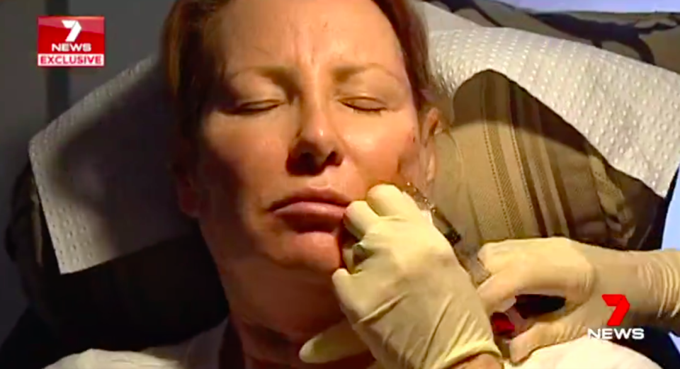 Australians are spending big money on botox and fillers, but lax regulations are putting some people in danger. Source: 7 News