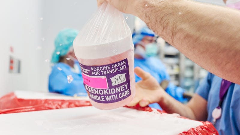 The gene-edited pig kidney with thymus is removed from its transport container to be prepared for transplantation - Photo: Joe Carrotta/NYU Langone Health